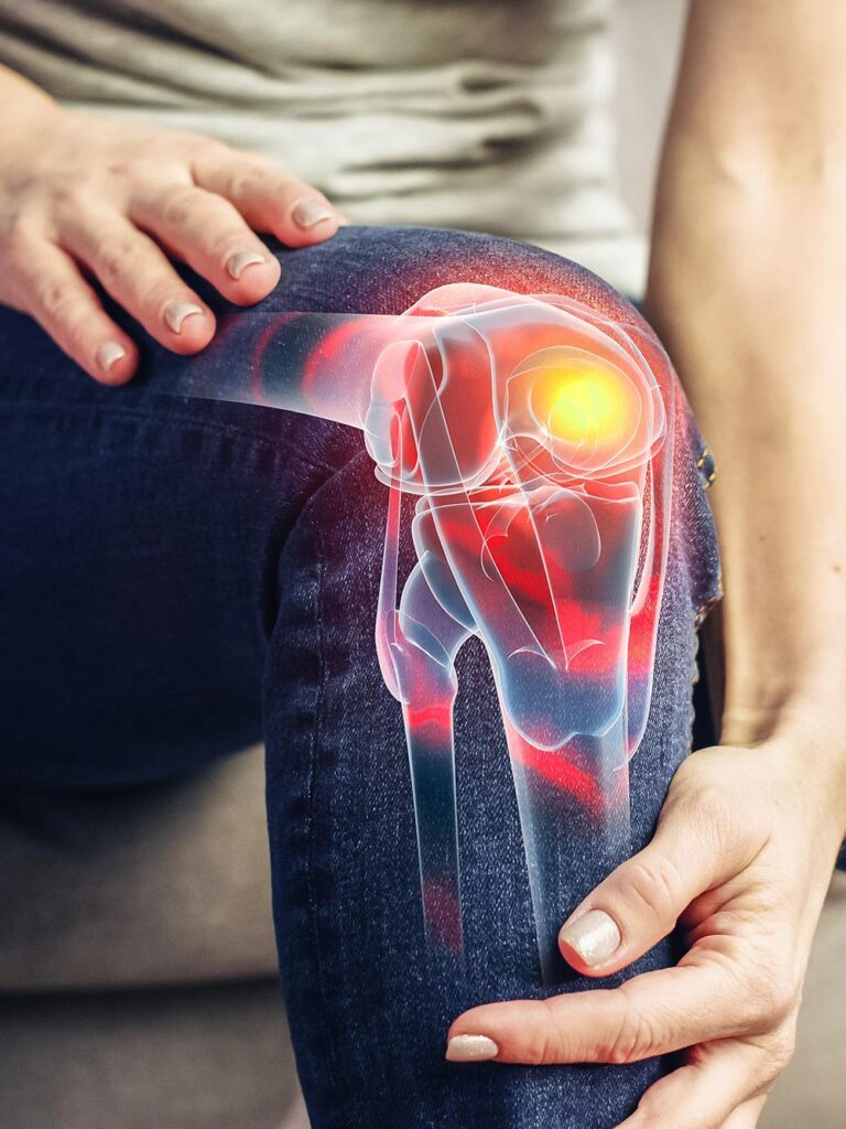 thoái hóa khớp gối